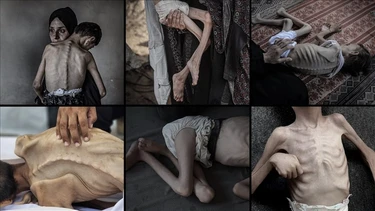 Raqamlarga aylangan falastinliklar: 7 oktabr voqealariga 2 yil toʻldi